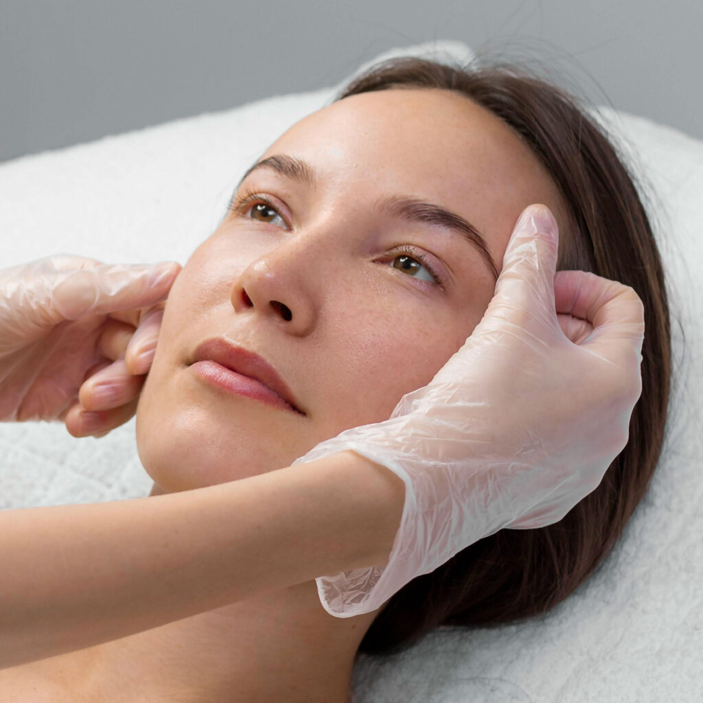 IPL Laser for Acne Treatment