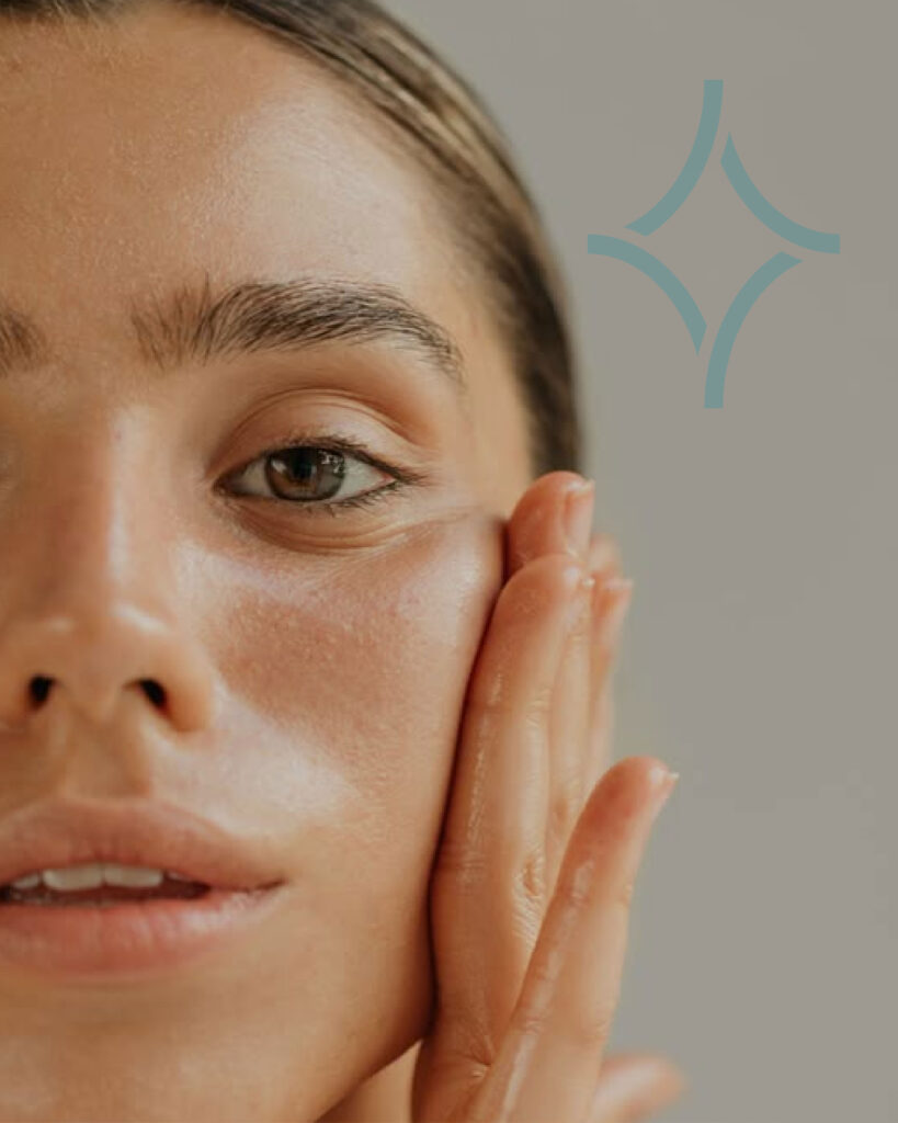 IPL Laser for Acne Treatment